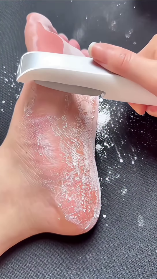 Professional Electronic Foot Scrubber for Smooth Skin Care